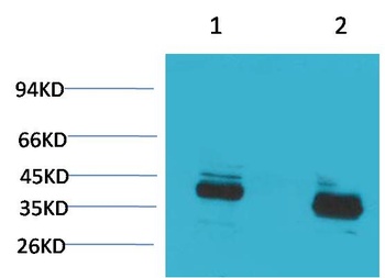 CABP Rabbit pAb Antibody