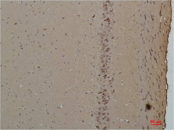 CABP Rabbit pAb Antibody