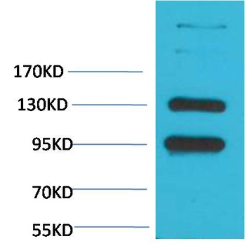 CaVα2δ1 Rabbit pAb Antibody