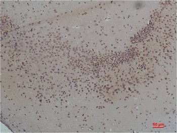 CaVα2δ1 Rabbit pAb Antibody