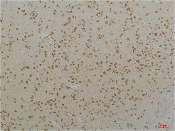Cav1.2 Rabbit pAb Antibody