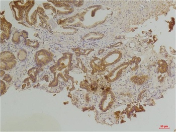 Endothelin B Receptor Rabbit pAb Antibody
