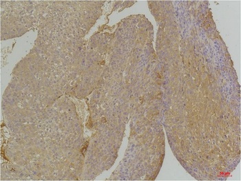 EphA1 Rabbit pAb Antibody