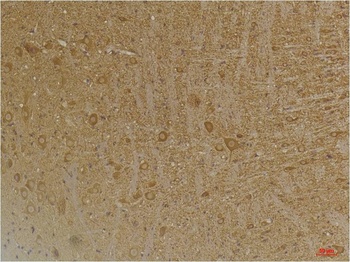 GABA B Receptor 2 Rabbit pAb Antibody