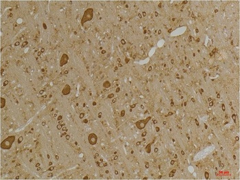 GABA A Receptor γ2 Rabbit pAb Antibody