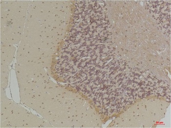 GABA Transporter 1 Rabbit pAb Antibody