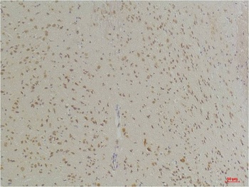 GABA Transporter 1 Rabbit pAb Antibody