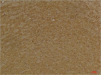 KCNK9(TASK-3) Rabbit pAb Antibody