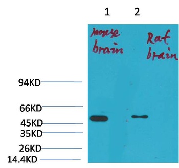 Kv1.1 potassium channel Rabbit pAb Antibody