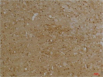Kv1.1 potassium channel Rabbit pAb Antibody