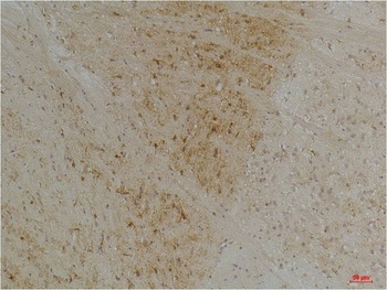 Kv1.1 potassium channel Rabbit pAb Antibody