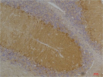 KCNN3(SK3) Rabbit pAb Antibody