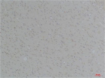 KCNN4(SK4) Rabbit pAb Antibody