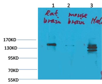 SLC12A4 Rabbit pAb Antibody