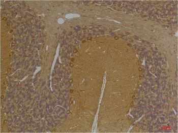 SLC12A4 Rabbit pAb Antibody