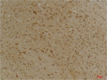 SLC12A4 Rabbit pAb Antibody