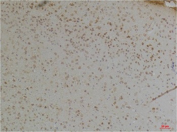 KChIP1 Rabbit pAb Antibody