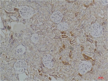 Kir4.1 Rabbit pAb Antibody