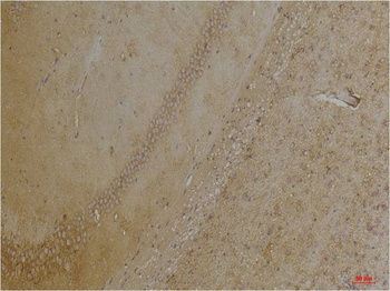 Kir4.1 Rabbit pAb Antibody