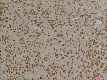 Kv10.1 Rabbit pAb Antibody