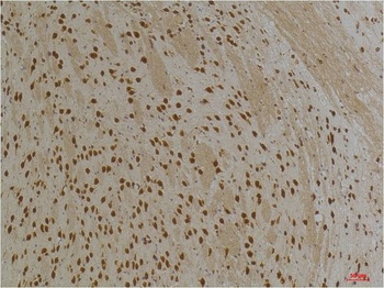 Kv10.1 Rabbit pAb Antibody