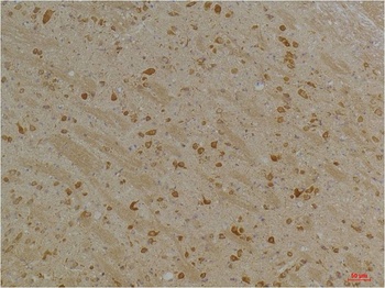 Kv10.2 Rabbit pAb Antibody