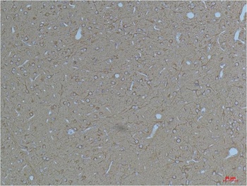 Kv11.3 Rabbit pAb Antibody
