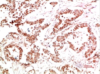 Met Rabbit pAb Antibody