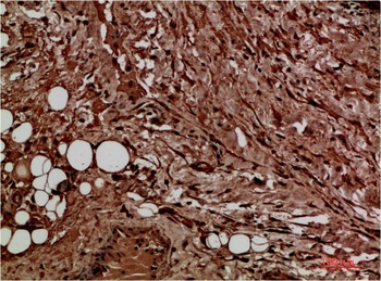 Met Rabbit pAb Antibody