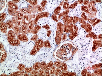 CD10 Rabbit pAb Antibody