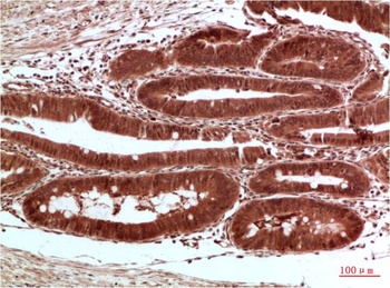 Acetyl-CoA Carboxylase Rabbit pAb Antibody