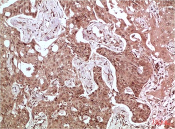 Acetyl-CoA Carboxylase Rabbit pAb Antibody