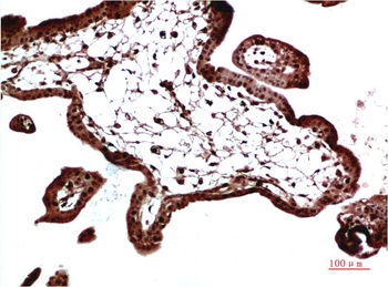 HP-1 γ Rabbit pAb Antibody