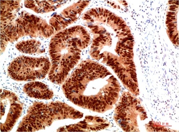 HSP40 Rabbit pAb Antibody