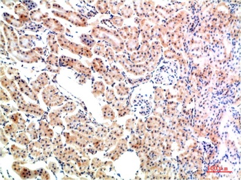 IkB α Rabbit pAb Antibody
