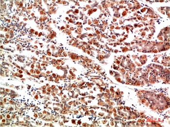 IkB α Rabbit pAb Antibody