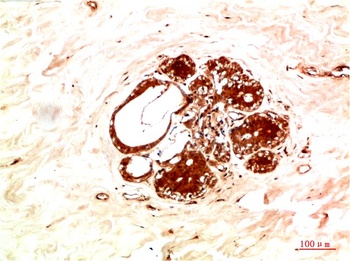 JAK2 Rabbit pAb Antibody