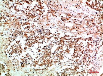 JAK2 Rabbit pAb Antibody