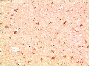 ATG4a Rabbit pAb Antibody
