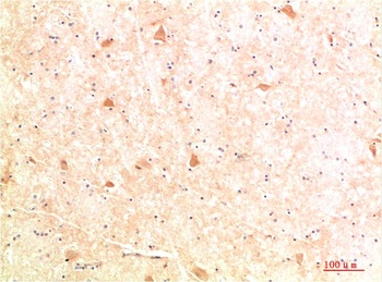 ATG4b Rabbit pAb Antibody