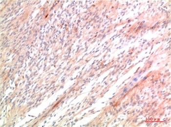 ATG5 Rabbit pAb Antibody