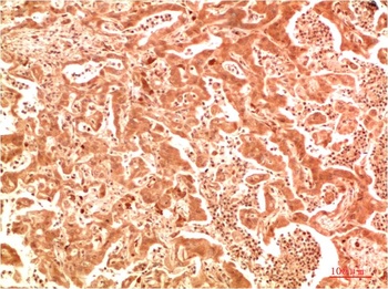 ATG7 Rabbit pAb Antibody