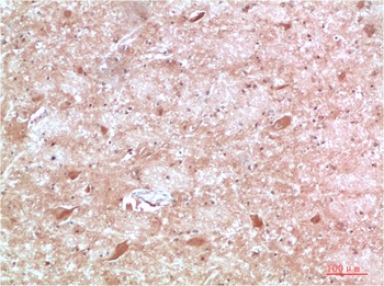 ATG13 Rabbit pAb Antibody