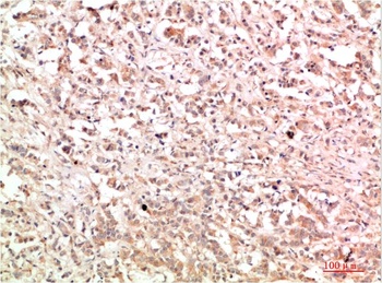c-Abl Rabbit pAb Antibody