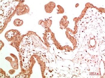 c-Abl Rabbit pAb Antibody