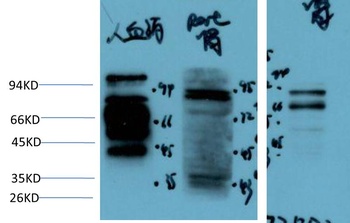 Kininogen 1 Rabbit pAb Antibody