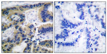 Cleaved-Caspase-7 (S199) rabbit pAb Antibody