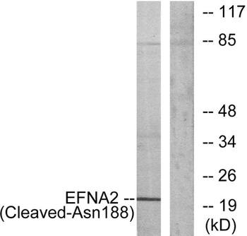 Cleaved-Ephrin-A2 (N188) rabbit pAb Antibody
