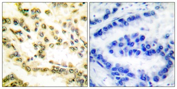 Cleaved-Lamin A (D230) rabbit pAb Antibody