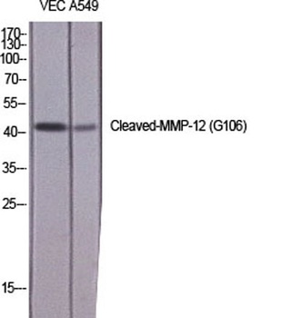 Cleaved-MMP-12 (G106) rabbit pAb Antibody